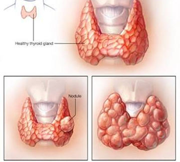 Thyroid Clinic